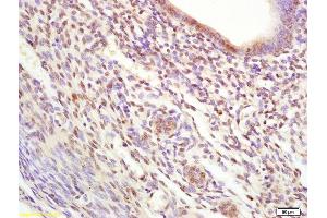 Formalin-fixed and paraffin embedded rat uterus tissue labeled with Anti-TIF1 beta/KAP1/TRIM28 Polyclonal Antibody, Unconjugated (ABIN701125) at 1:200 followed by conjugation to the secondary antibody and DAB staining (KAP1 antibody  (AA 651-750))