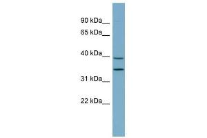 PRKAB1 antibody used at 1 ug/ml to detect target protein. (PRKAB1 antibody  (N-Term))