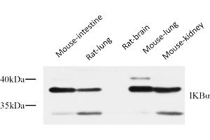 Western Blot analysis of Mouse intesting (1), rat lung (2), rat brain (3), mouse lung (4), mouse kidney (5), diluted at 1:1000. (NFKBIA antibody  (AA 10-90))