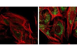 Immunofluorescence (IF) image for anti-Sequestosome 1 (SQSTM1) antibody (ABIN2854836)