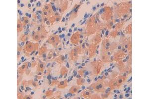 IHC-P analysis of stomach tissue, with DAB staining. (PTPN9 antibody  (AA 289-593))