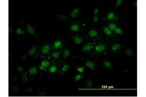 Immunofluorescence of monoclonal antibody to DNMT2 on HeLa cell. (Dnmt2 antibody  (AA 1-391))