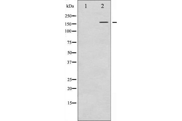 FANCD2 antibody  (pSer222)