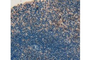 IHC-P analysis of Human Tissue, with DAB staining. (CD226 antibody  (AA 19-254))