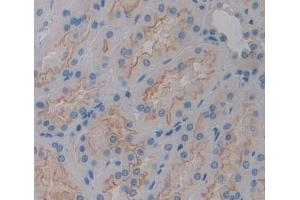 #VALUE! (PLCH2 antibody  (AA 1-257))