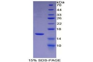 SDS-PAGE analysis of Mouse Coagulation Factor VII Protein. (Factor VII Protein)