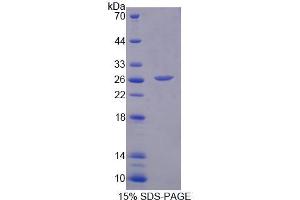 SDS-PAGE analysis of Human MCCC2 Protein. (MCCC2 Protein)