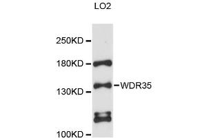 Western blot analysis of extracts of LO2 cells, using WDR35 antibody (ABIN6293806) at 1:3000 dilution. (WDR35 antibody)