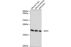 Western blot analysis of extracts of various cell lines, using  Rabbit mAb (ABIN7265485) at 1:1000 dilution. (ARF6 antibody)