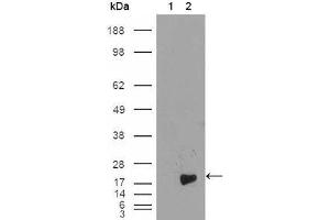 Western blot analysis using Survivin mouse mAb against HEK293T cells transfected with the pCMV6-ENTRY control (1) and pCMV6-ENTRY Survivin cDNA (2). (Survivin antibody)