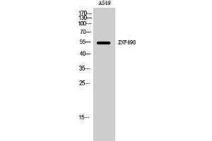 Western Blotting (WB) image for anti-Zinc Finger and SCAN Domain Containing 25 (ZSCAN25) (Internal Region) antibody (ABIN6282352) (Zinc Finger and SCAN Domain Containing 25 (ZSCAN25) (Internal Region) antibody)