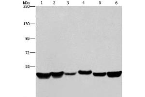 Western Blot analysis of LoVo and A375 cell, Mouse brain tissue, HepG2, A431 and Hela cell using HNRNPH1 Polyclonal Antibody at dilution of 1:350 (HNRNPH1 antibody)