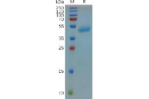 Human R(22-146) Protein, hFc Tag on SDS-PAGE under reducing condition. (R-Spondin 3 Protein (RSPO3) (AA 22-146) (Fc Tag))