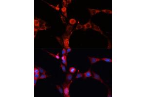 Immunofluorescence analysis of NIH-3T3 cells using SMPD1 / ASM Polyclonal Antibody (ABIN7270530) at dilution of 1:100 (40x lens). (SMPD1 antibody)