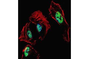 Immunofluorescence (IF) image for anti-Retinoic Acid Receptor, beta (RARB) antibody (ABIN2999994) (Retinoic Acid Receptor beta antibody)