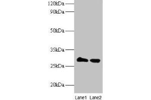 Western blot All lanes: TPMT antibody at 2 μg/mL Lane 1: EC109 whole cell lysate Lane 2: 293T whole cell lysate Secondary Goat polyclonal to rabbit IgG at 1/15000 dilution Predicted band size: 29 kDa Observed band size: 29 kDa (TPMT antibody  (AA 4-244))