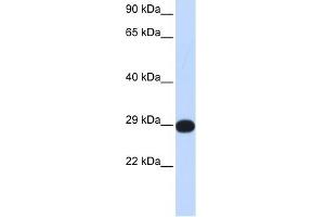 PPP4C antibody used at 1 ug/ml to detect target protein. (PPP4C antibody)