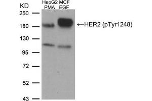 Western blot analysis of extracts from HepG2 cells treated with PMA and MCF cells treated with EGF, using HER2 (Phospho-Tyr1248) Antibody. (ErbB2/Her2 antibody  (pTyr1248))