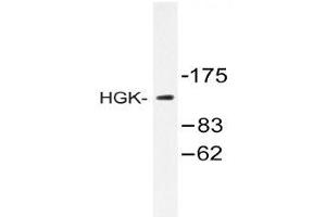 Western blot (WB) analysis of HGK antibody in extracts from HUVEC cells. (MAP4K4 antibody)