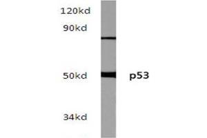 Western blot (WB) analysis of p53 pAb in extracts from hela cells. (p53 antibody)