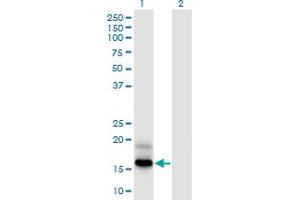 Western Blot analysis of PFDN4 expression in transfected 293T cell line by PFDN4 monoclonal antibody (M03), clone 2G4. (PFDN4 antibody  (AA 1-134))
