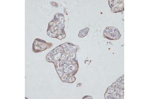 Immunohistochemistry of paraffin-embedded human placenta using TFRC antibody. (Transferrin Receptor antibody  (AA 1-140))