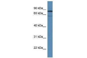 Western Blot showing Tdp1 antibody used at a concentration of 1. (TDP1 antibody  (Middle Region))