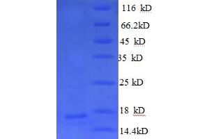 SDS-PAGE (SDS) image for Neurofascin (NFASC) (AA 1239-1347) protein (His tag) (ABIN4974263) (NFASC Protein (AA 1239-1347) (His tag))