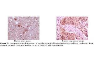 Image no. 2 for anti-Mitogen-Activated Protein Kinase 10 (MAPK10) antibody (ABIN207628) (MAPK10 antibody)