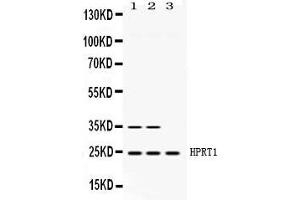 Western blot analysis of HPRT1 expression in rat brain extract ( Lane 1), mouse brain extract ( Lane 2) and HELA whole cell lysates ( Lane 3). (HPRT1 antibody  (AA 2-110))