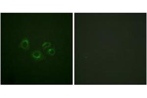 Immunofluorescence analysis of A549 cells, using EPHA2/3/4 (Ab-588/596) Antibody. (EPHA2/3/4 antibody  (AA 556-605))