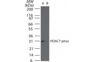 Image no. 1 for anti-Histone Deacetylase 7 (HDAC7) (pSer155) antibody (ABIN225621) (HDAC7 antibody  (pSer155))