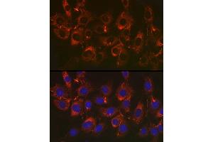 Immunofluorescence analysis of NIH/3T3 cells using Fibronectin Rabbit mAb (ABIN6133698, ABIN6135676, ABIN6135677 and ABIN7101415) at dilution of 1:50 (40x lens). (Fibronectin 1 antibody)