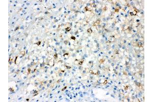 Anti- TLR5 Picoband antibody, IHC(P) IHC(P): Human Appendicitis Tissue (TLR5 antibody  (C-Term))