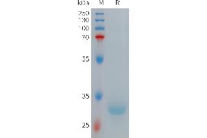 Human HAMP(65-84) Protein, hFc Tag on SDS-PAGE under reducing condition. (Hepcidin Protein (AA 65-84) (Fc Tag))
