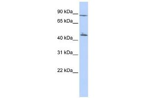 C6ORF199 antibody used at 1 ug/ml to detect target protein. (AKD1 antibody  (N-Term))