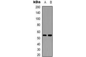 Western blot analysis of Cytochrome P450 2W1 expression in Hela (A), HepG2 (B) whole cell lysates. (CYP2W1 antibody)