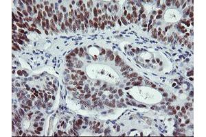 Image no. 1 for anti-Tumor Protein P53 (TP53) antibody (ABIN1499978) (p53 antibody)