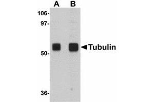 Image no. 1 for anti-alpha Tubulin (TUBA1) (N-Term) antibody (ABIN478060) (alpha Tubulin antibody  (N-Term))