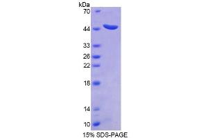 SDS-PAGE analysis of Human STAM2 Protein. (STAM2 Protein)