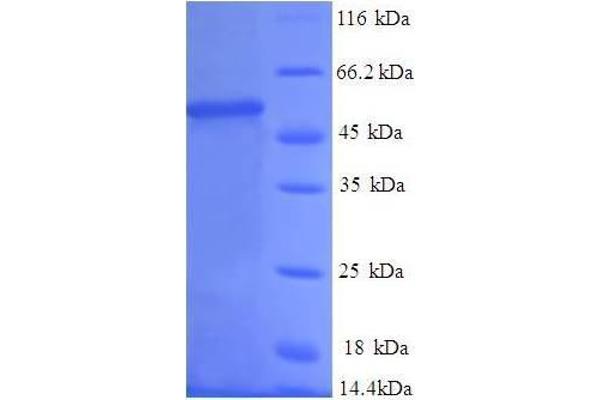 PSMB1 Protein (AA 29-241, full length) (GST tag)