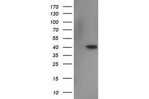 HEK293T cells were transfected with the pCMV6-ENTRY control (Left lane) or pCMV6-ENTRY NECAB1 (Right lane) cDNA for 48 hrs and lysed. (NECAB1 antibody)