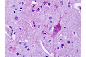 Anti-MGLUR4 antibody IHC of human brain, cortex, neurons. (Metabotropic Glutamate Receptor 4 antibody  (C-Term))