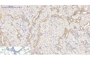 Immunohistochemistry of paraffin-embedded Rat lung tissue using CD20 Monoclonal Antibody at dilution of 1:200. (CD20 antibody)
