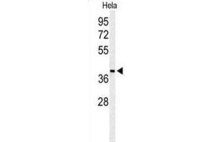 Western Blotting (WB) image for anti-ADP-Ribosylhydrolase Like 2 (ADPRHL2) antibody (ABIN3004293) (ADPRHL2 antibody)