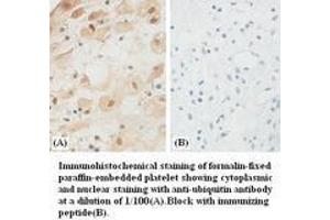 Image no. 1 for anti-Ubiquitin (Ubiquitin) antibody (ABIN791138) (Ubiquitin antibody)