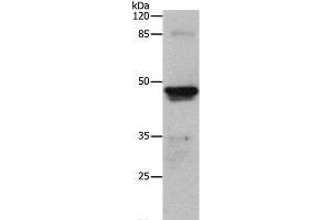 Western Blot analysis of Human ovarian cancer tissue using CK-15 Polyclonal Antibody at dilution of 1:300 (KRT15 antibody)