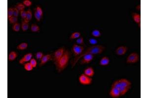 Immunofluorescent analysis of HepG2 cells using ABIN7167780 at dilution of 1:100 and Cy3-congugated Goat Anti-Rabbit IgG (RLBP1 antibody  (AA 10-91))