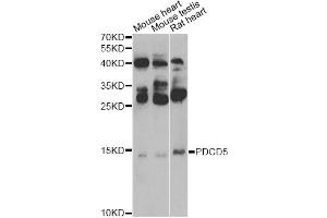 Western blot analysis of extracts of various cell lines, using PDCD5 Antibody. (PDCD5 antibody)