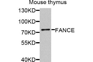 Western blot analysis of extracts of mouse thymus, using FANCE antibody (ABIN5974901) at 1/1000 dilution. (FANCE antibody)